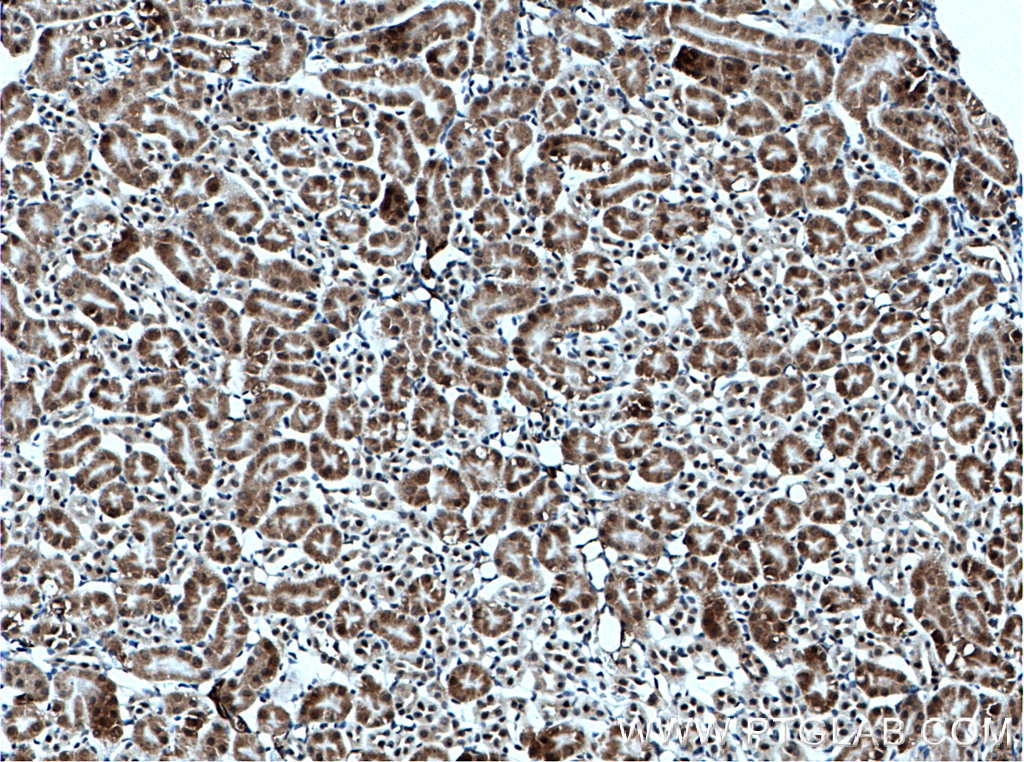 Immunohistochemistry (IHC) staining of mouse kidney tissue using C1orf106 Polyclonal antibody (21506-1-AP)
