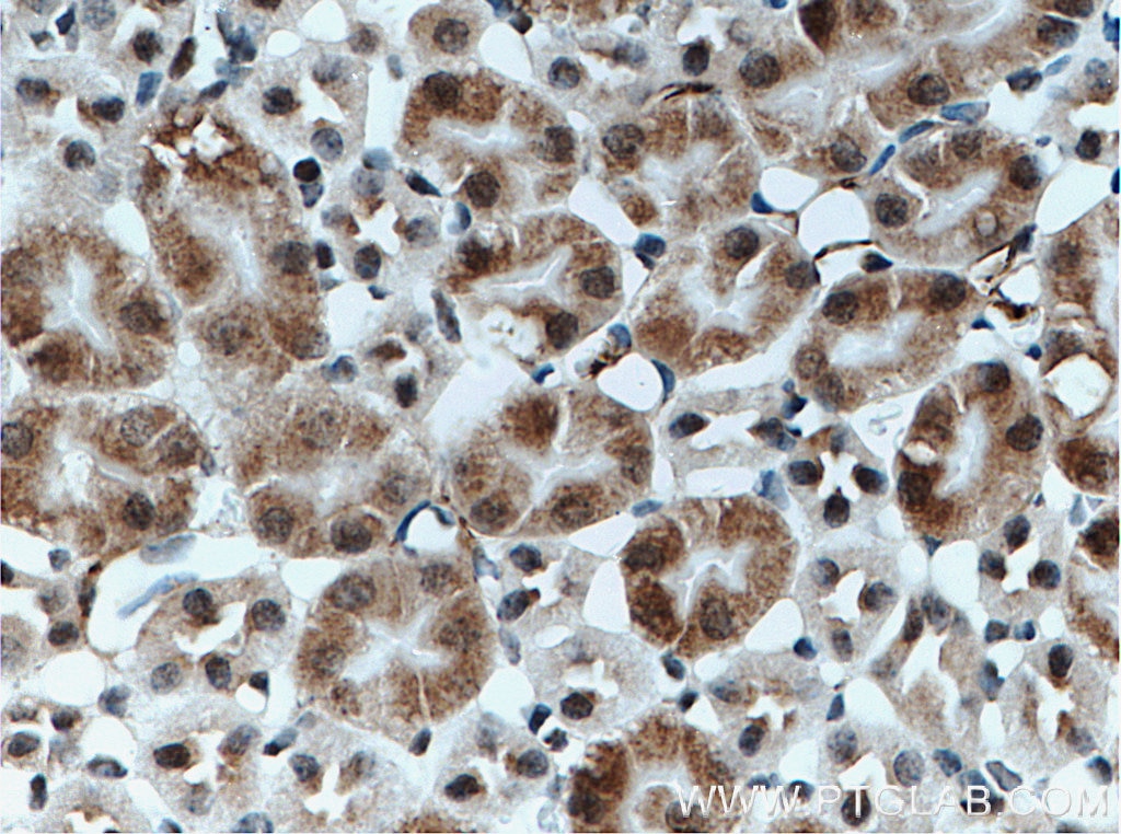 Immunohistochemistry (IHC) staining of mouse kidney tissue using C1orf106 Polyclonal antibody (21506-1-AP)