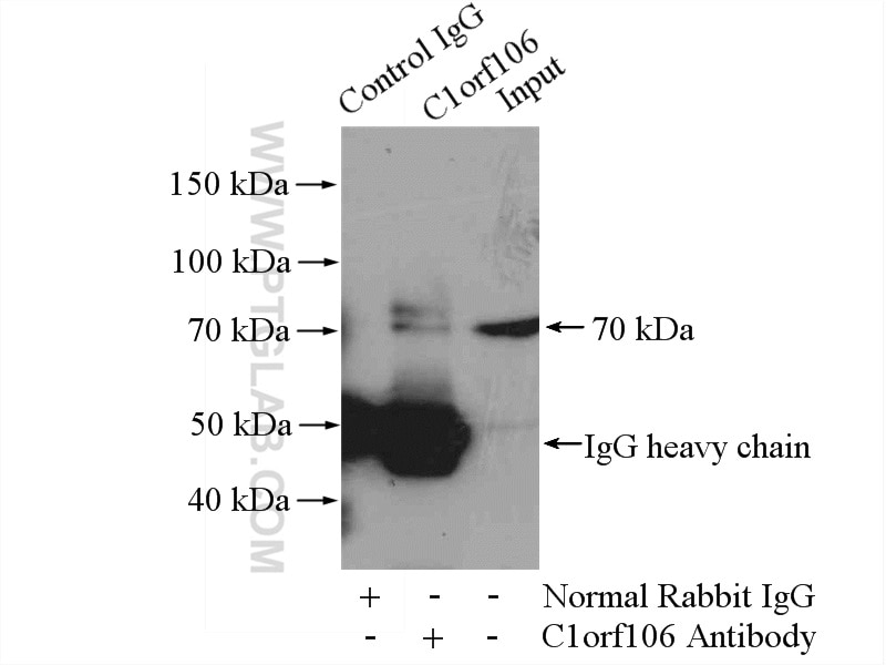 Immunoprecipitation (IP) experiment of mouse kidney tissue using C1orf106 Polyclonal antibody (21506-1-AP)