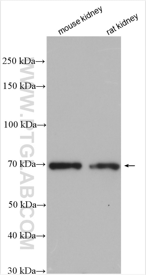 Western Blot (WB) analysis of various lysates using C1orf106 Polyclonal antibody (21506-1-AP)