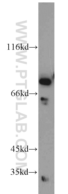 Western Blot (WB) analysis of HEK-293 cells using C1orf106 Polyclonal antibody (21506-1-AP)