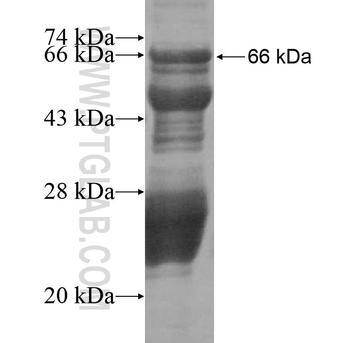 C1orf106 fusion protein Ag15987 SDS-PAGE