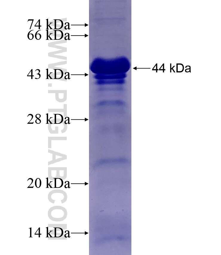 C1orf106 fusion protein Ag17321 SDS-PAGE