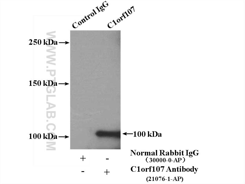 Immunoprecipitation (IP) experiment of HepG2 cells using C1orf107 Polyclonal antibody (21076-1-AP)