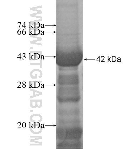 C1orf107 fusion protein Ag15250 SDS-PAGE