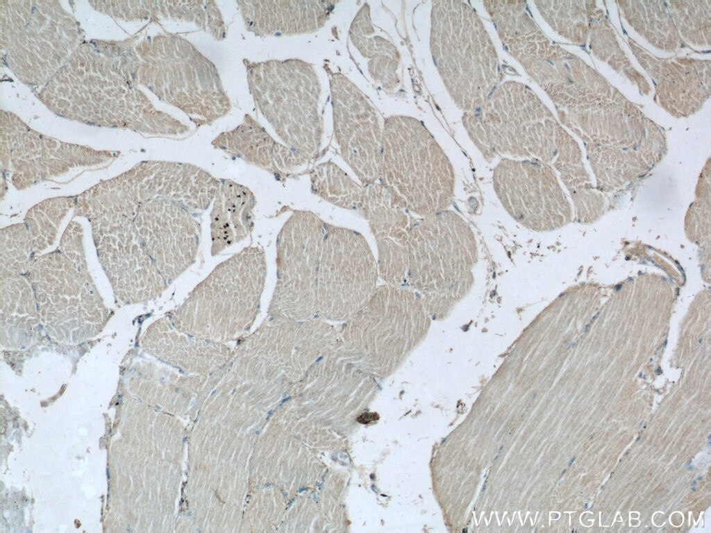 Immunohistochemistry (IHC) staining of human skeletal muscle tissue using C1orf111 Polyclonal antibody (24808-1-AP)