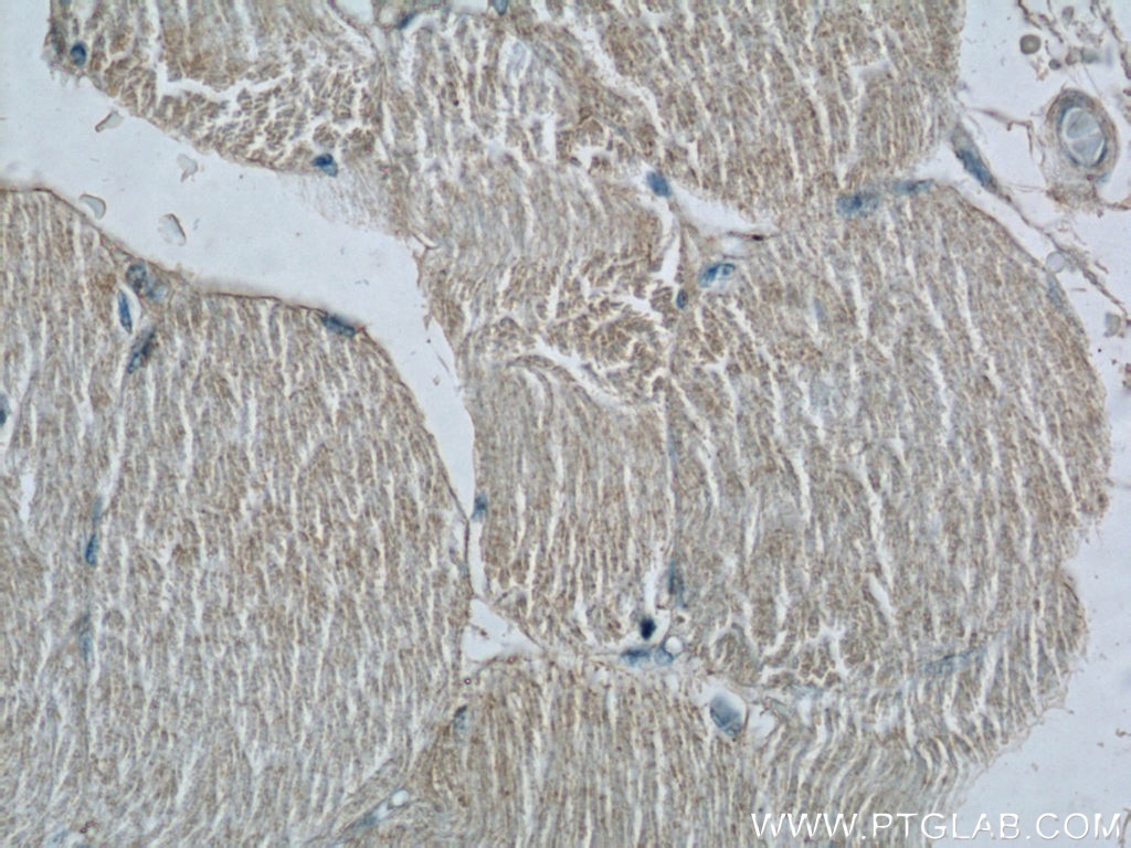 Immunohistochemistry (IHC) staining of human skeletal muscle tissue using C1orf111 Polyclonal antibody (24808-1-AP)