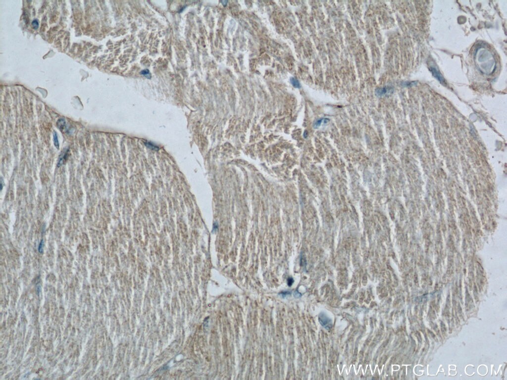 Immunohistochemistry (IHC) staining of human skeletal muscle tissue using C1orf111 Polyclonal antibody (24808-1-AP)