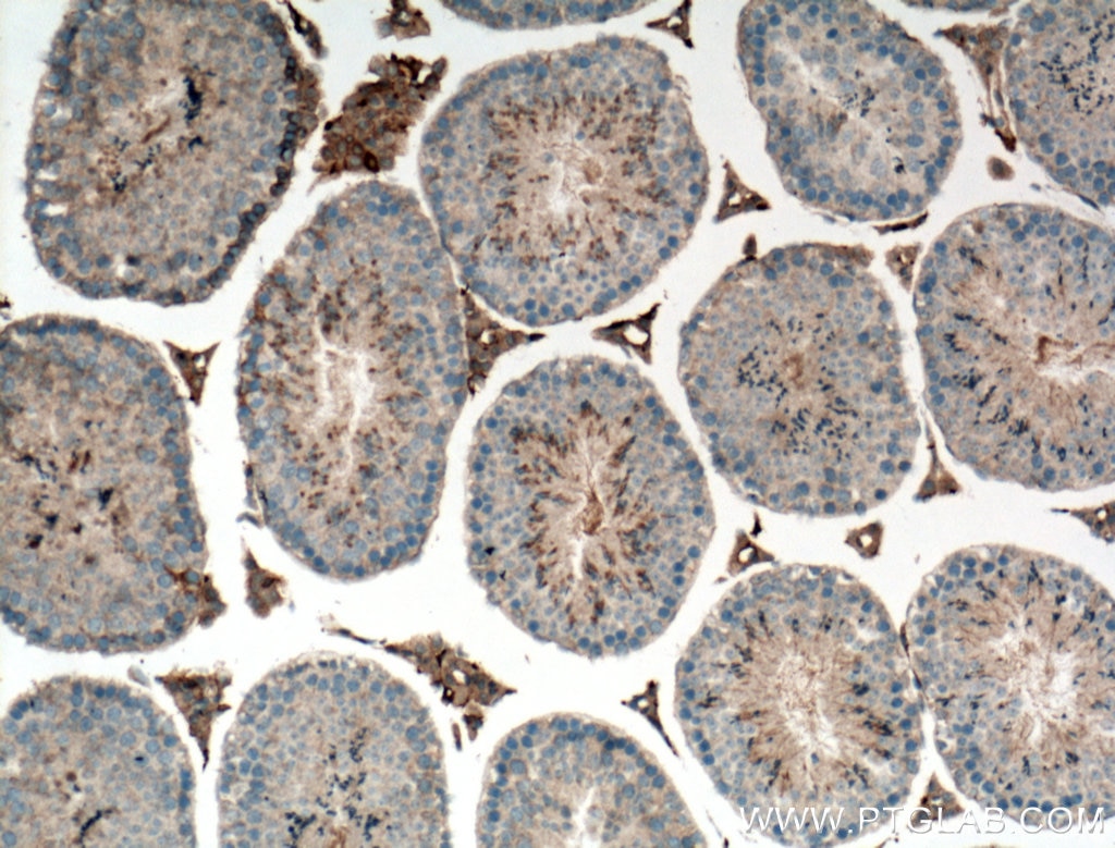 Immunohistochemistry (IHC) staining of mouse testis tissue using C1orf113 Polyclonal antibody (25767-1-AP)