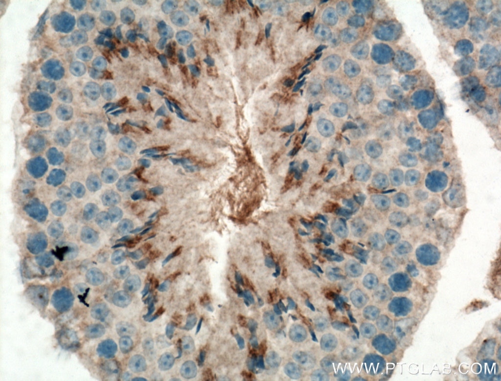 Immunohistochemistry (IHC) staining of mouse testis tissue using C1orf113 Polyclonal antibody (25767-1-AP)