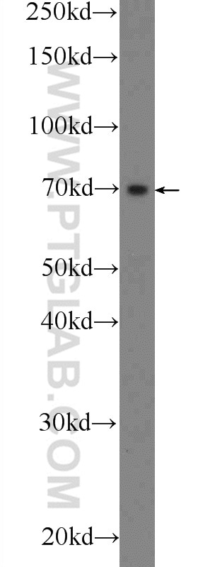 Western Blot (WB) analysis of mouse testis tissue using C1orf113 Polyclonal antibody (25767-1-AP)