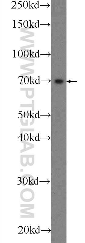 WB analysis of mouse testis using 25767-1-AP