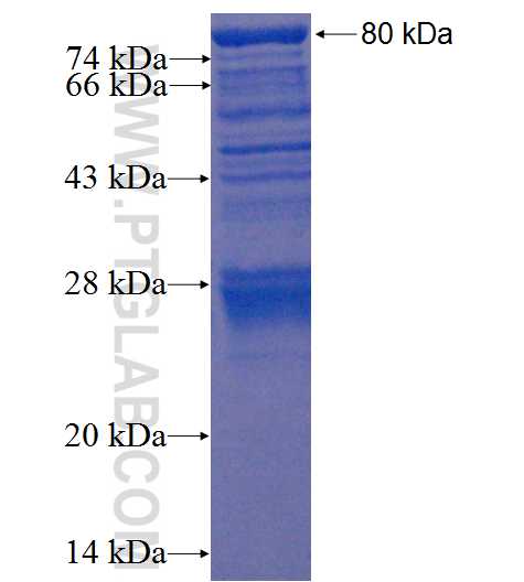 C1orf113 fusion protein Ag22643 SDS-PAGE