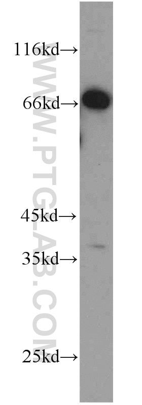 Western Blot (WB) analysis of PC-3 cells using C1orf116 Polyclonal antibody (14888-1-AP)
