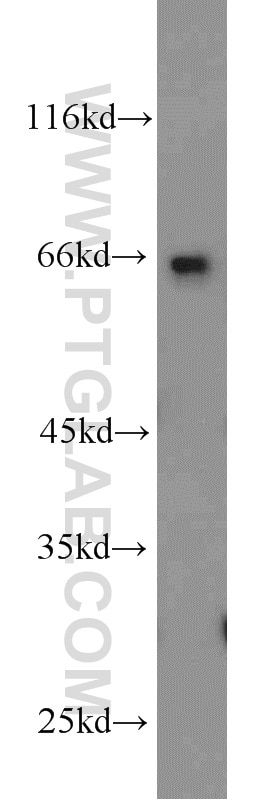 Western Blot (WB) analysis of mouse testis tissue using C1orf116 Polyclonal antibody (14888-1-AP)