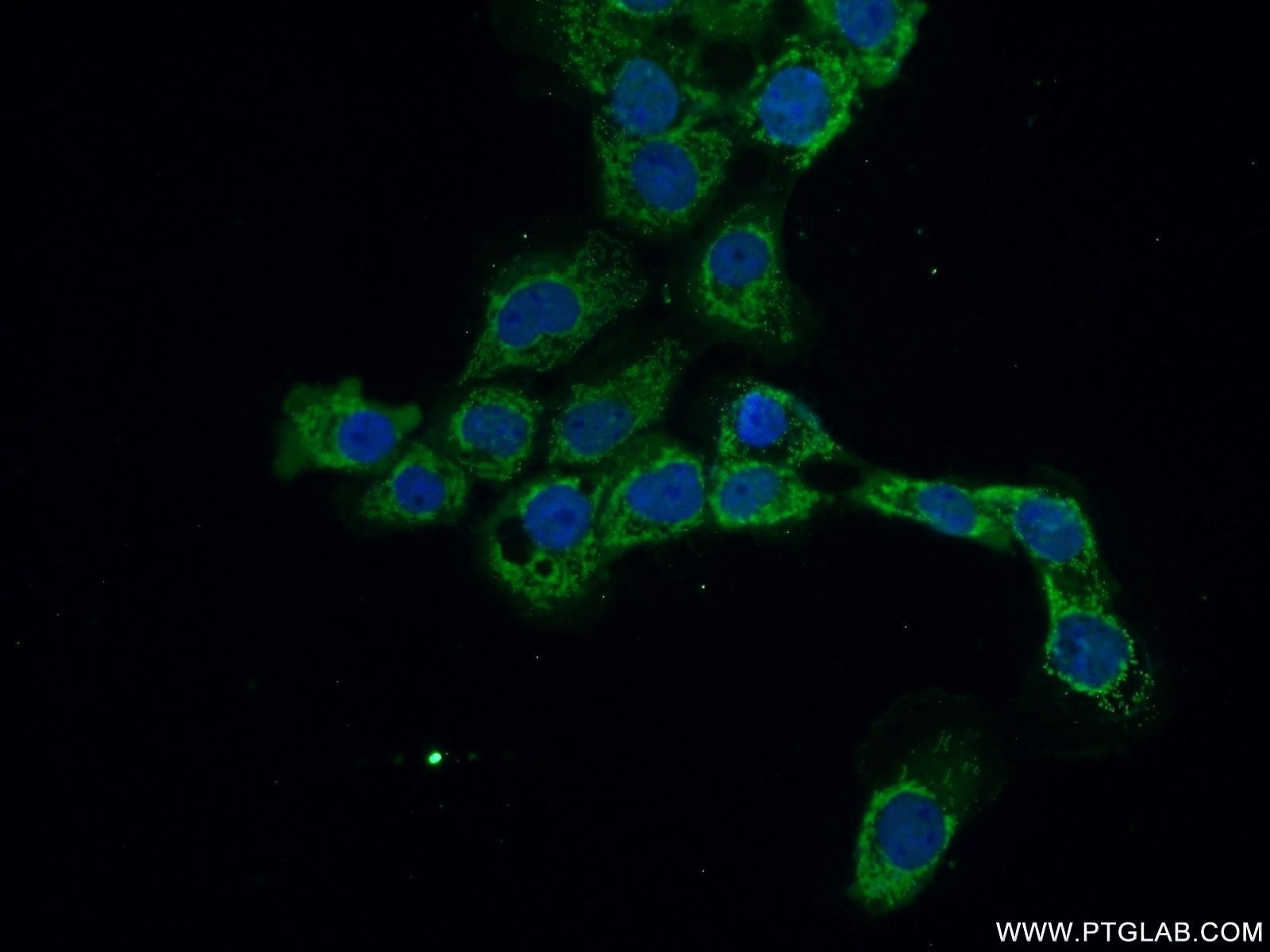 Immunofluorescence (IF) / fluorescent staining of A431 cells using METTL18 Polyclonal antibody (25553-1-AP)