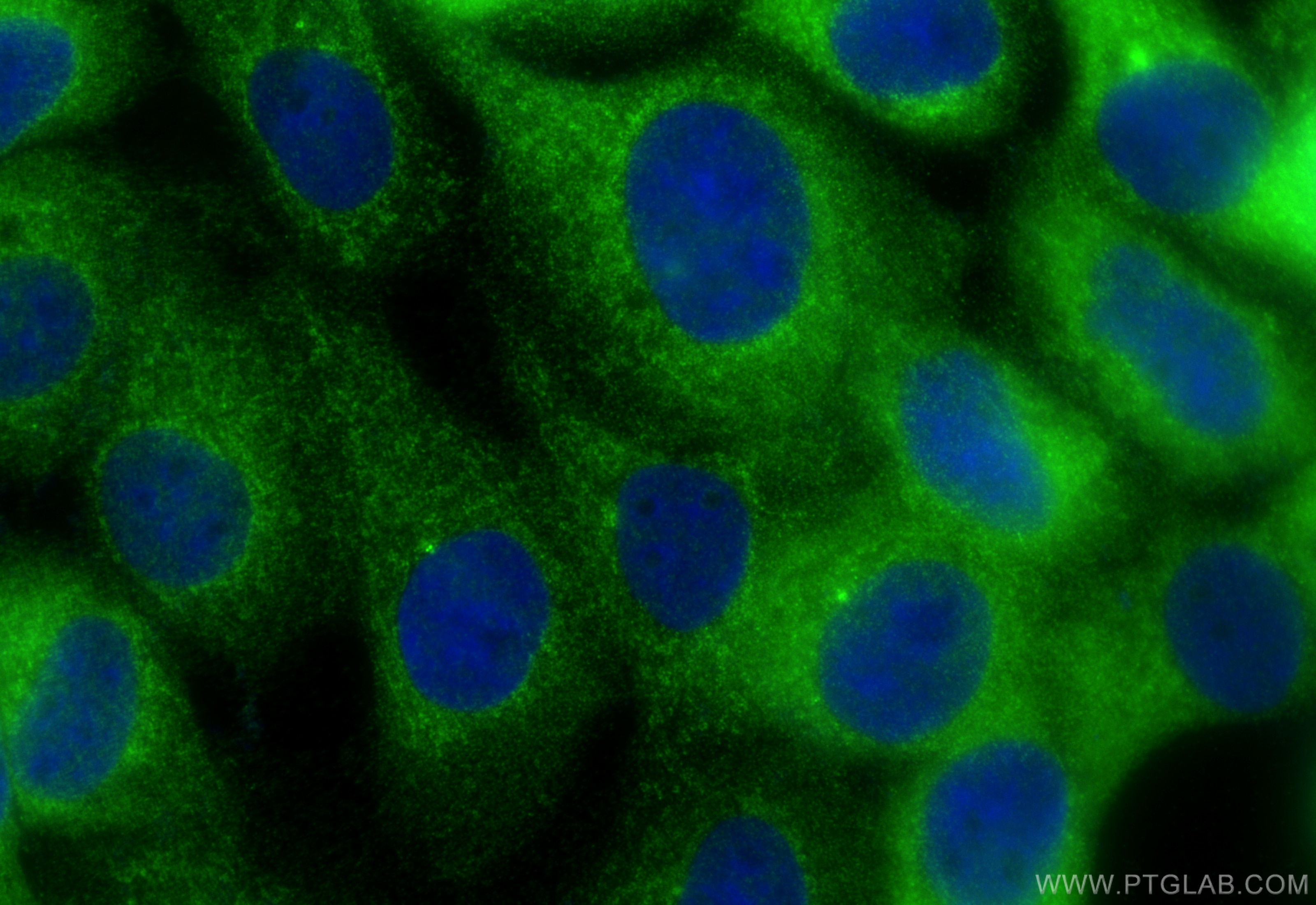 Immunofluorescence (IF) / fluorescent staining of A431 cells using METTL18 Polyclonal antibody (25553-1-AP)