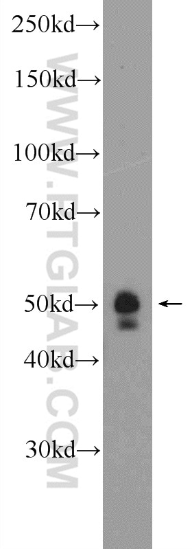 Western Blot (WB) analysis of PC-3 cells using METTL18 Polyclonal antibody (25553-1-AP)