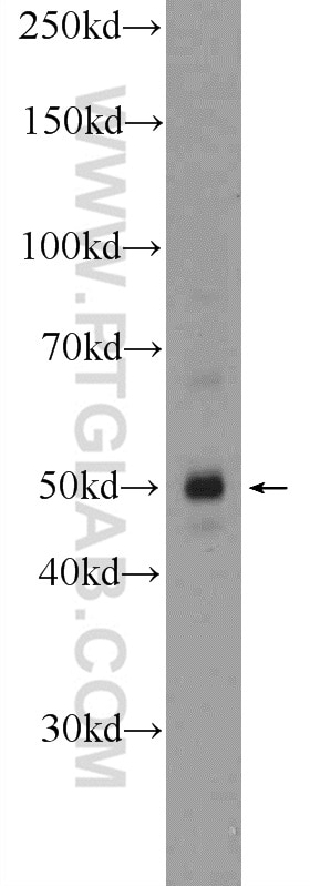 Western Blot (WB) analysis of A431 cells using METTL18 Polyclonal antibody (25553-1-AP)
