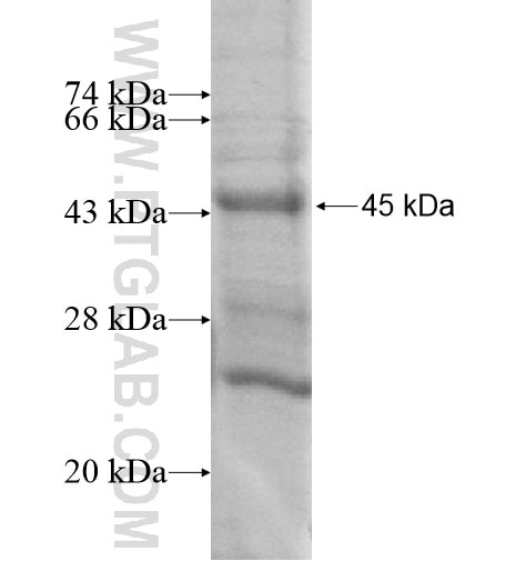 C1orf159 fusion protein Ag15122 SDS-PAGE