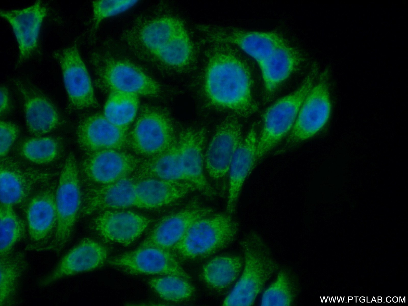Immunofluorescence (IF) / fluorescent staining of PC-3 cells using COA7 Polyclonal antibody (25361-1-AP)
