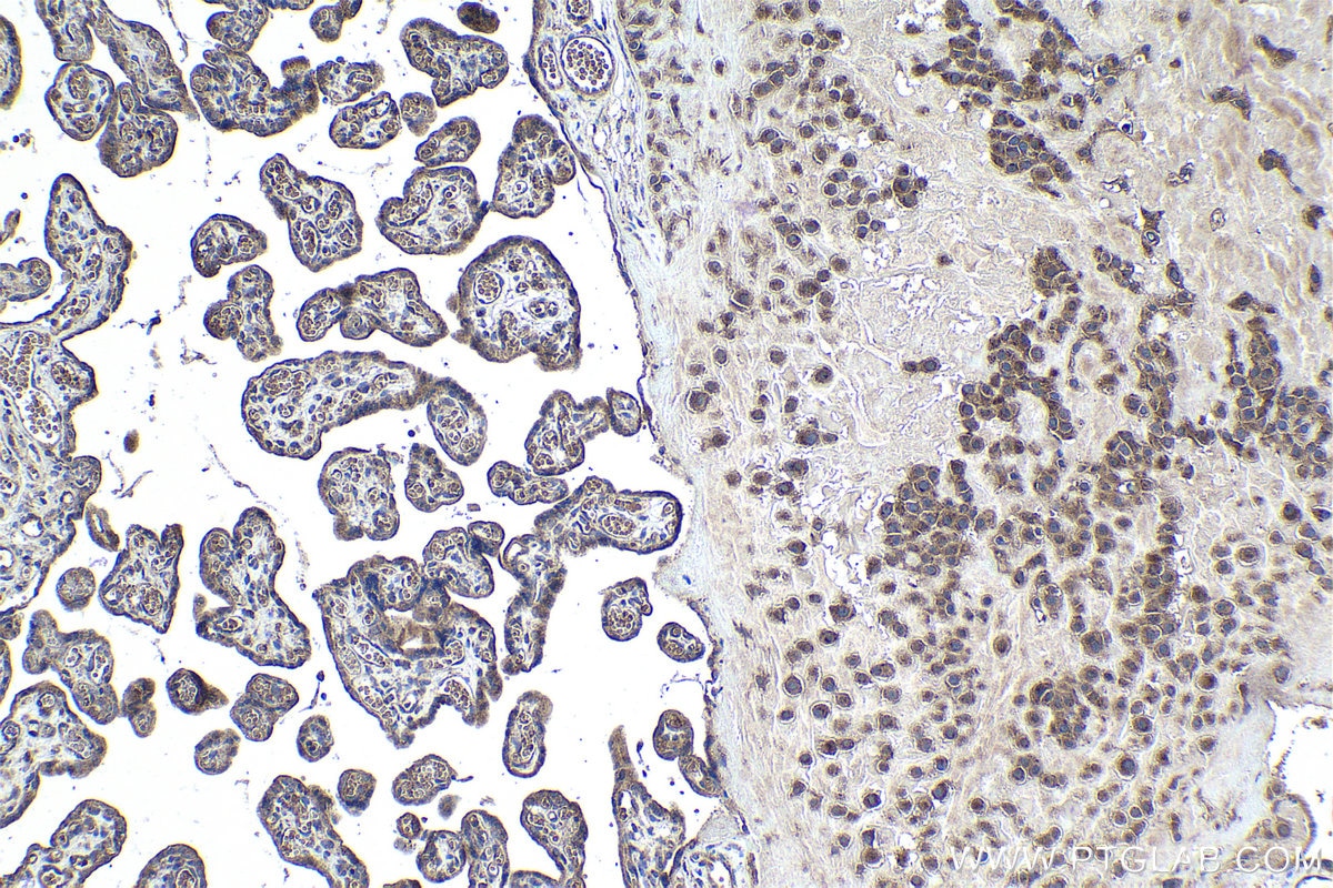 Immunohistochemistry (IHC) staining of human placenta tissue using COA7 Polyclonal antibody (25361-1-AP)