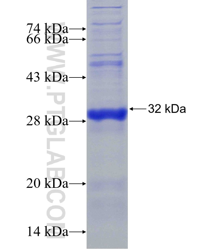 C1orf170 fusion protein Ag23833 SDS-PAGE