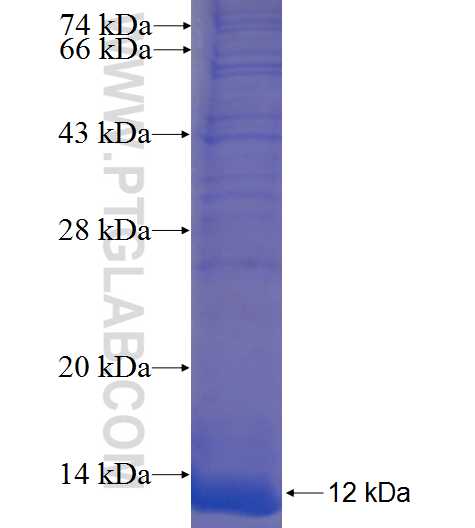 C1orf170 fusion protein Ag23886 SDS-PAGE