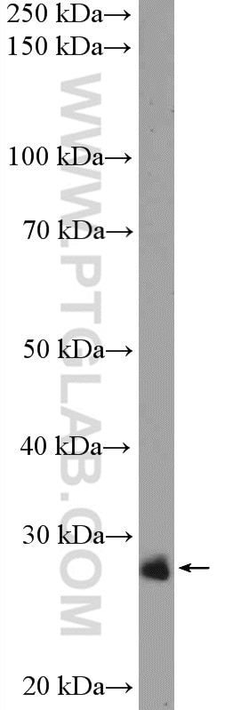 Western Blot (WB) analysis of HL-60 cells using C1orf216 Polyclonal antibody (26265-1-AP)