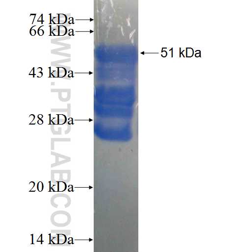 C1orf216 fusion protein Ag22665 SDS-PAGE