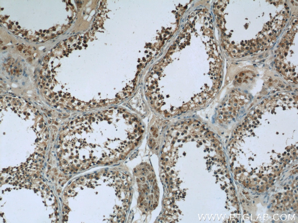 Immunohistochemistry (IHC) staining of human testis tissue using TEX38 Polyclonal antibody (24429-1-AP)
