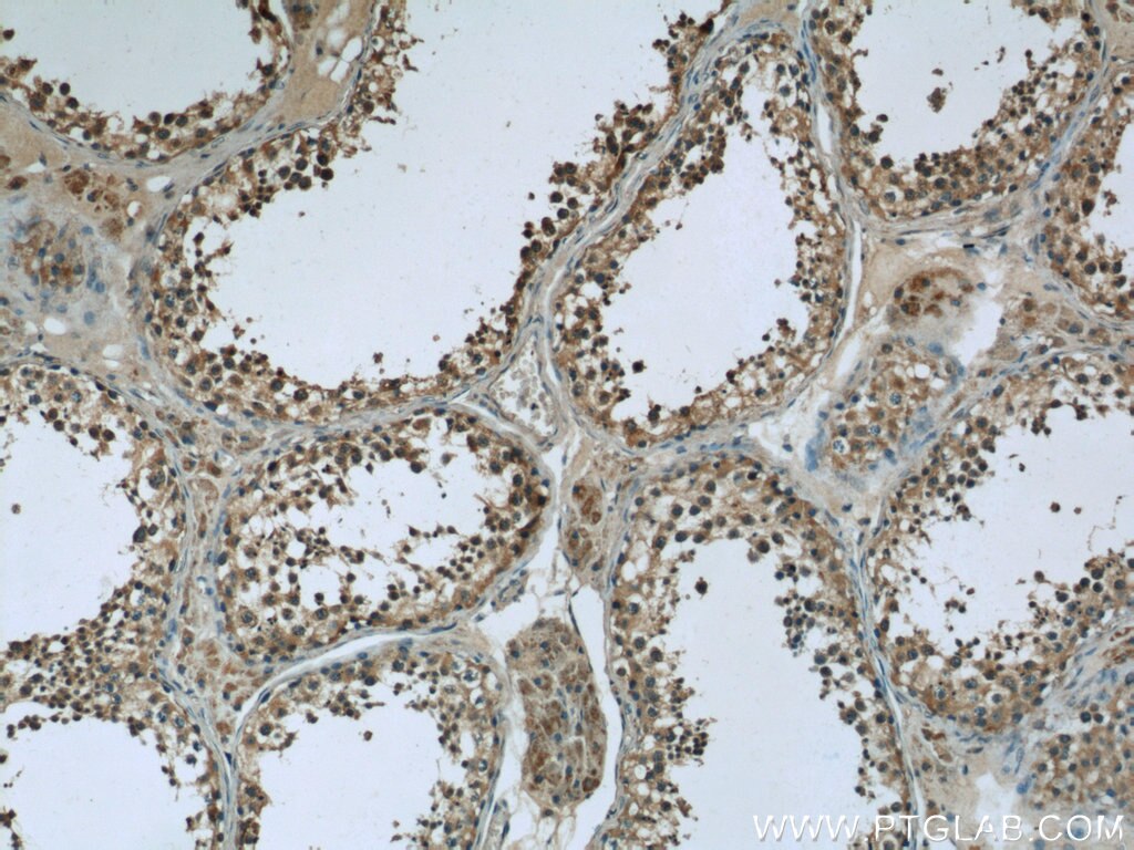 IHC staining of human testis using 24429-1-AP