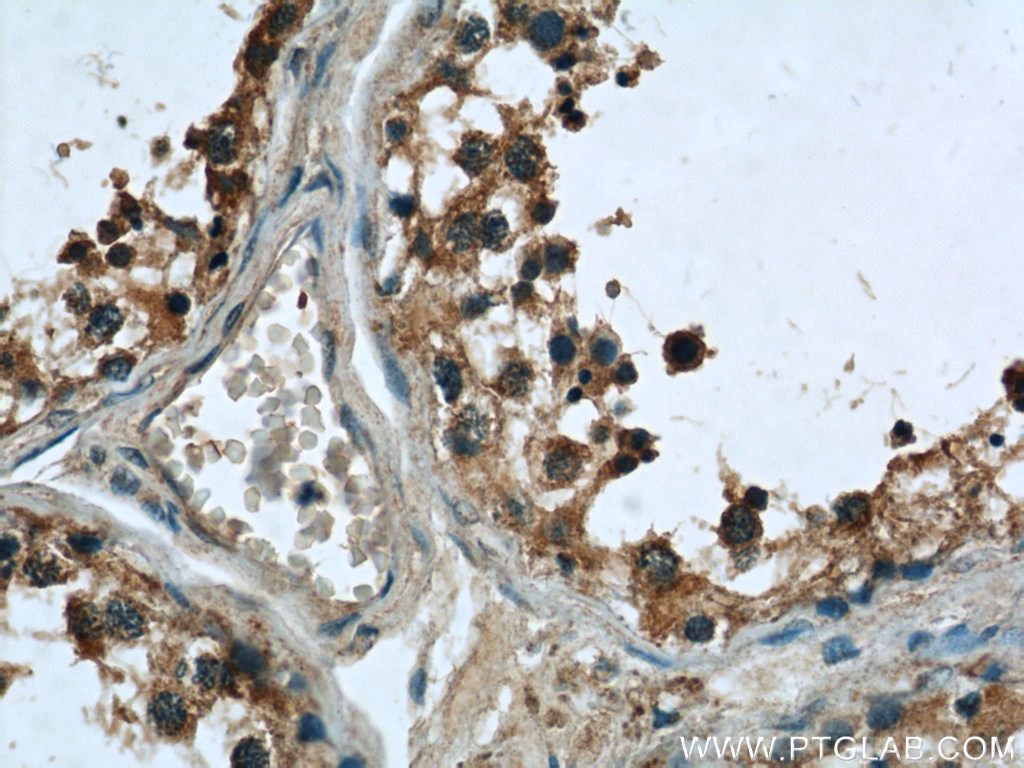 Immunohistochemistry (IHC) staining of human testis tissue using TEX38 Polyclonal antibody (24429-1-AP)