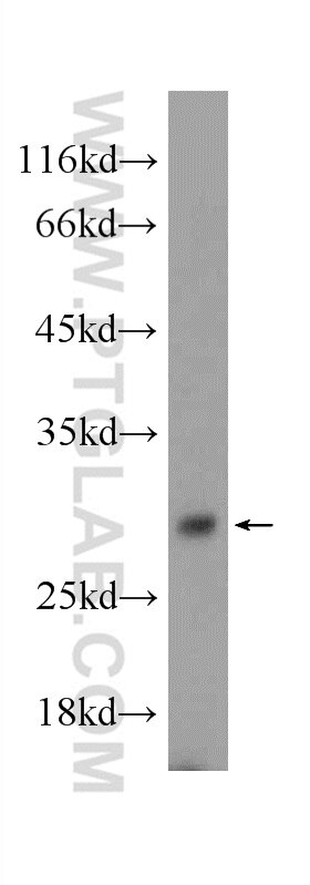 Western Blot (WB) analysis of mouse testis tissue using TEX38 Polyclonal antibody (24429-1-AP)