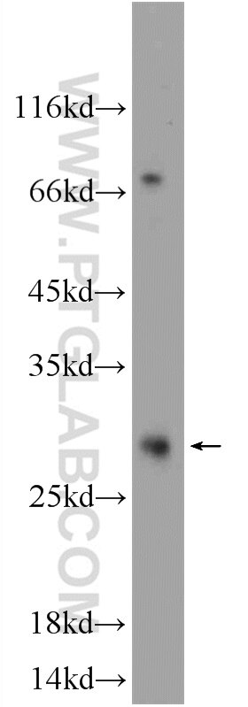 Western Blot (WB) analysis of MDA-MB-453s cells using TEX38 Polyclonal antibody (24429-1-AP)