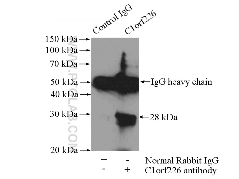 Immunoprecipitation (IP) experiment of A431 cells using C1orf226 Polyclonal antibody (26061-1-AP)