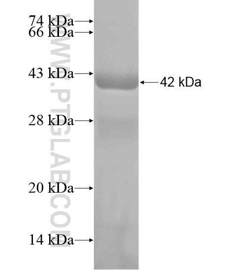 C1orf26 fusion protein Ag19655 SDS-PAGE