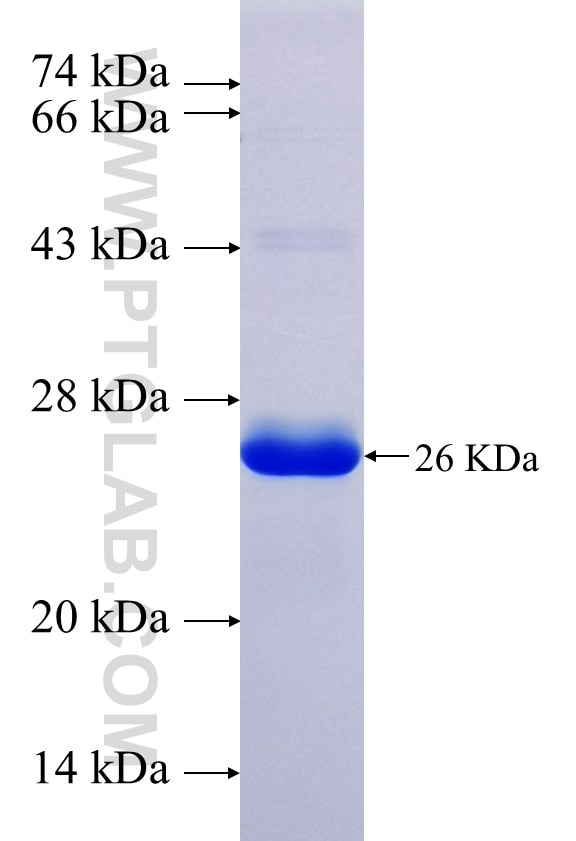 C1orf27 fusion protein Ag39123 SDS-PAGE C1orf27 fusion protein Ag39123 SDS-PAGE