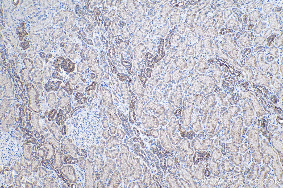 IHC staining of human kidney using 24209-1-AP