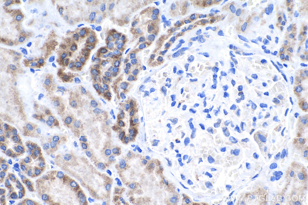 Immunohistochemistry (IHC) staining of human kidney tissue using COA6 Polyclonal antibody (24209-1-AP)