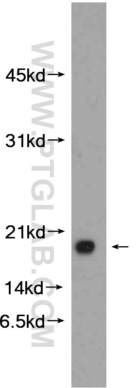 WB analysis of mouse liver using 24209-1-AP