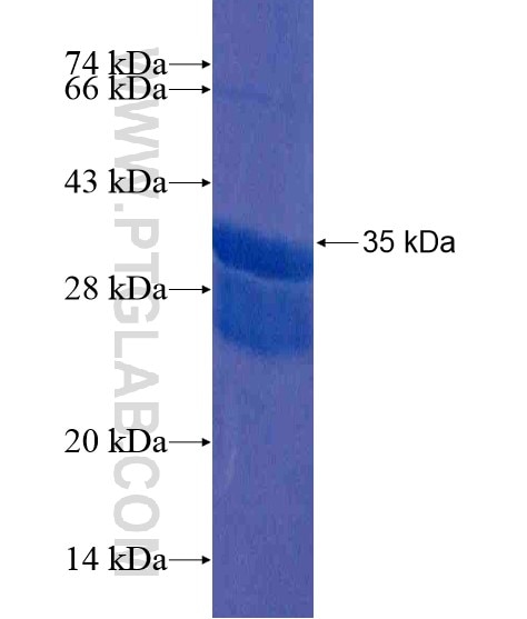 C1orf31 fusion protein Ag21525 SDS-PAGE