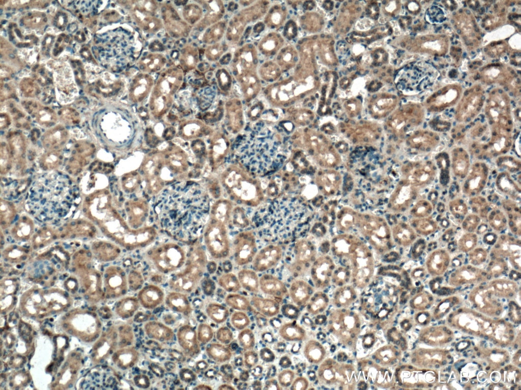 Immunohistochemistry (IHC) staining of human kidney tissue using C1orf35 Polyclonal antibody (27930-1-AP)