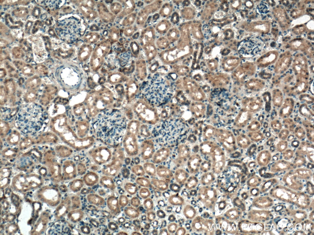 IHC staining of human kidney using 27930-1-AP