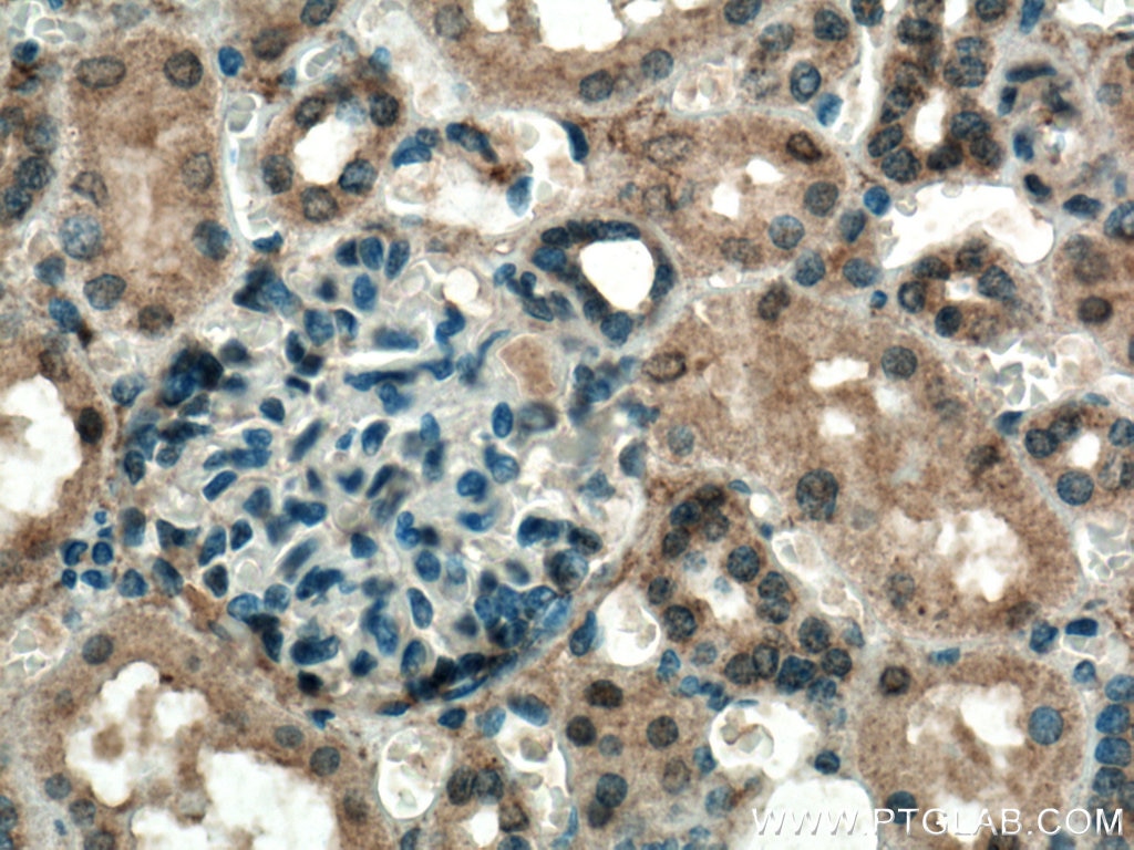 IHC staining of human kidney using 27930-1-AP