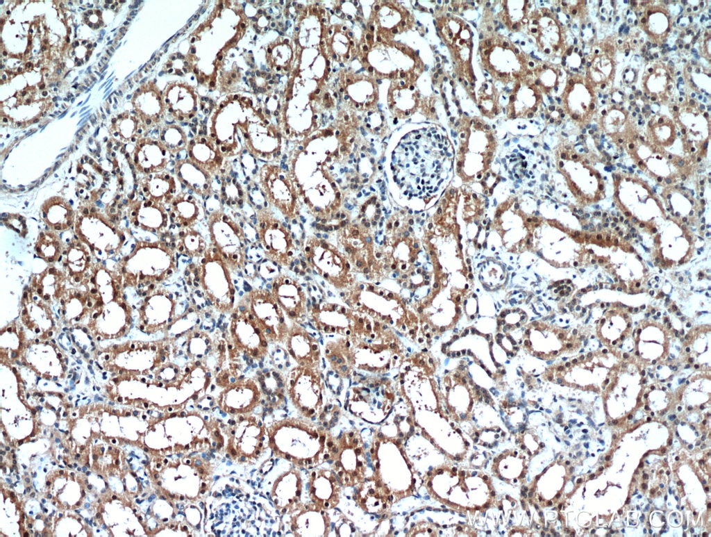 Immunohistochemistry (IHC) staining of human kidney tissue using C1orf50 Polyclonal antibody (20957-1-AP)