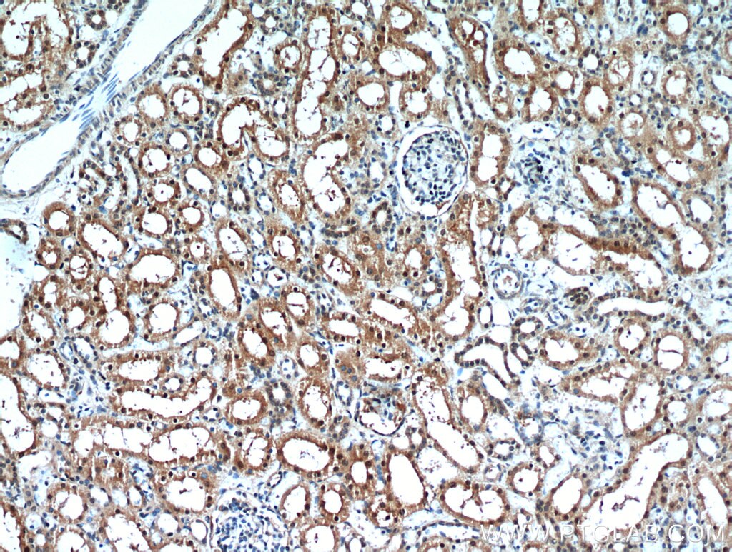 IHC staining of human kidney using 20957-1-AP