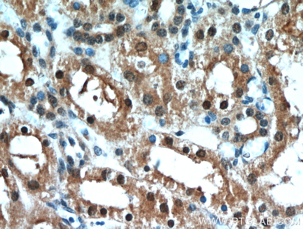 Immunohistochemistry (IHC) staining of human kidney tissue using C1orf50 Polyclonal antibody (20957-1-AP)