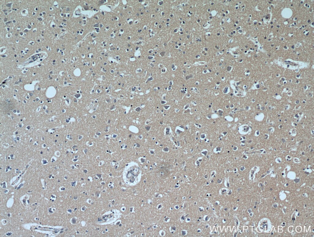 Immunohistochemistry (IHC) staining of human brain tissue using C1orf50 Polyclonal antibody (20957-1-AP)