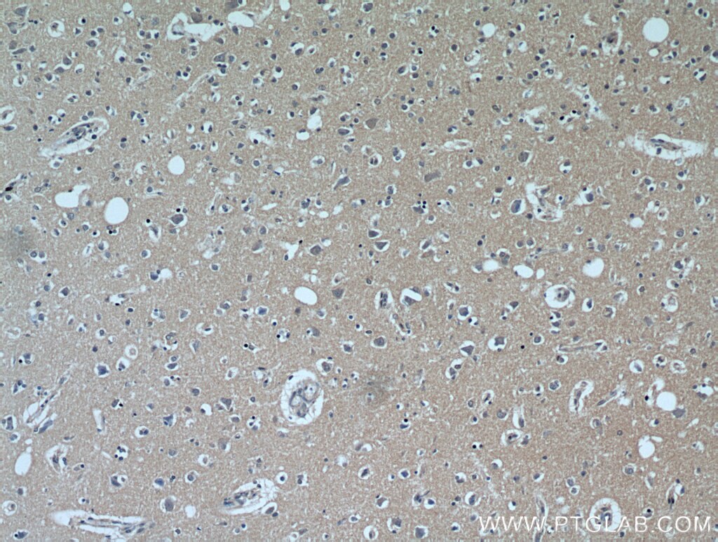 IHC staining of human brain using 20957-1-AP